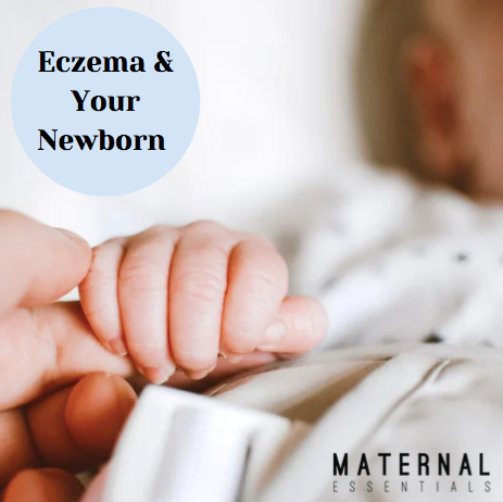 Eczema & your newborn